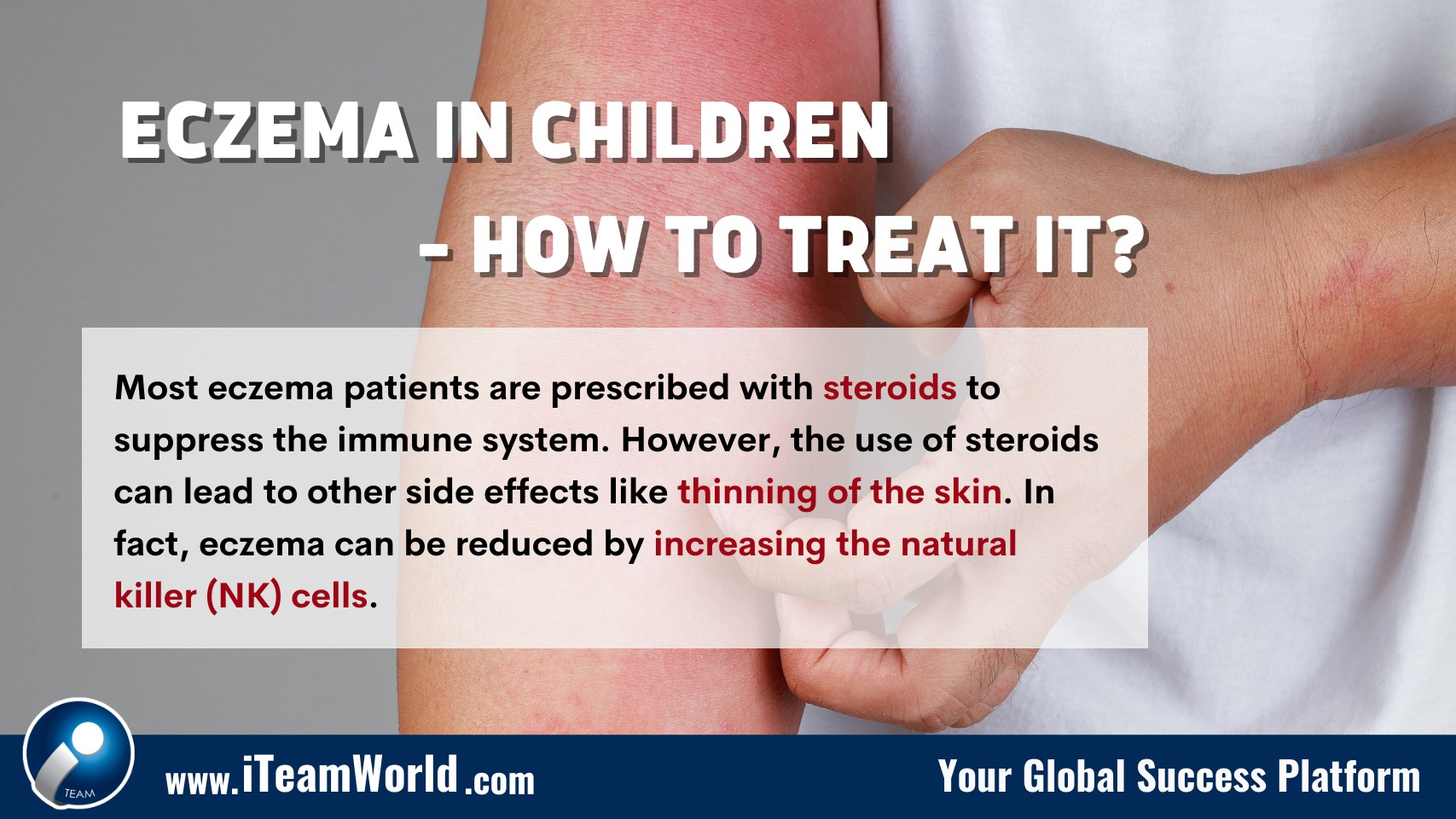 Eczema kid