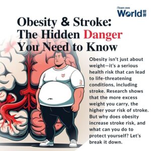 Obesity & Stroke