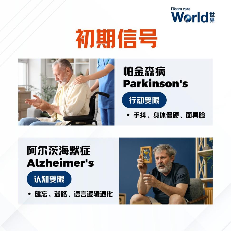 Parkinson's Alzheimer's